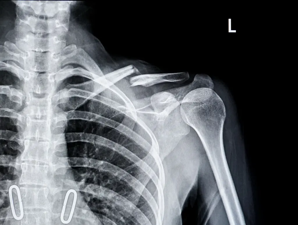 oil rig worker dangers