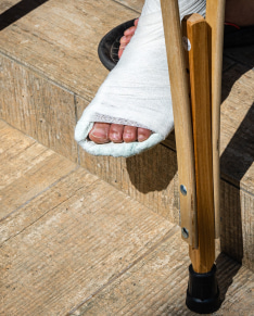 leg in plaster.